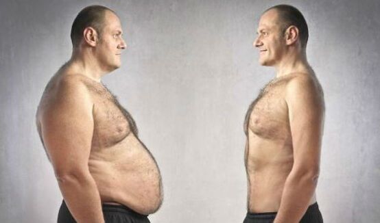 Men and women want to get rid of a large abdomen