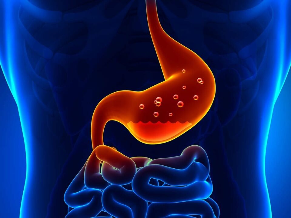 Gastritis is an inflammatory disease of the stomach that requires diet. 